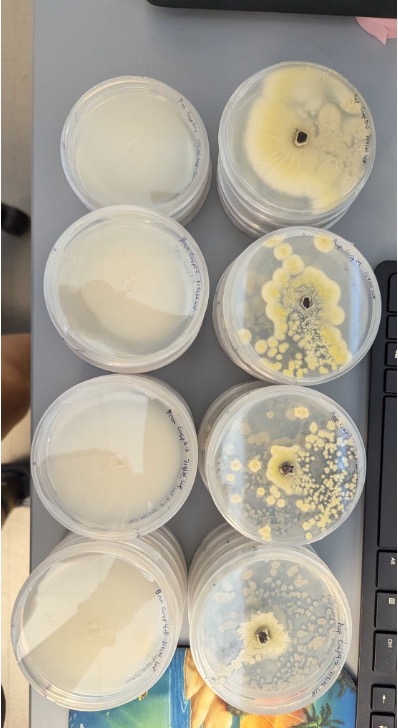 Antifungal Resistance Mechanisms in Emerging Zoopagomycota