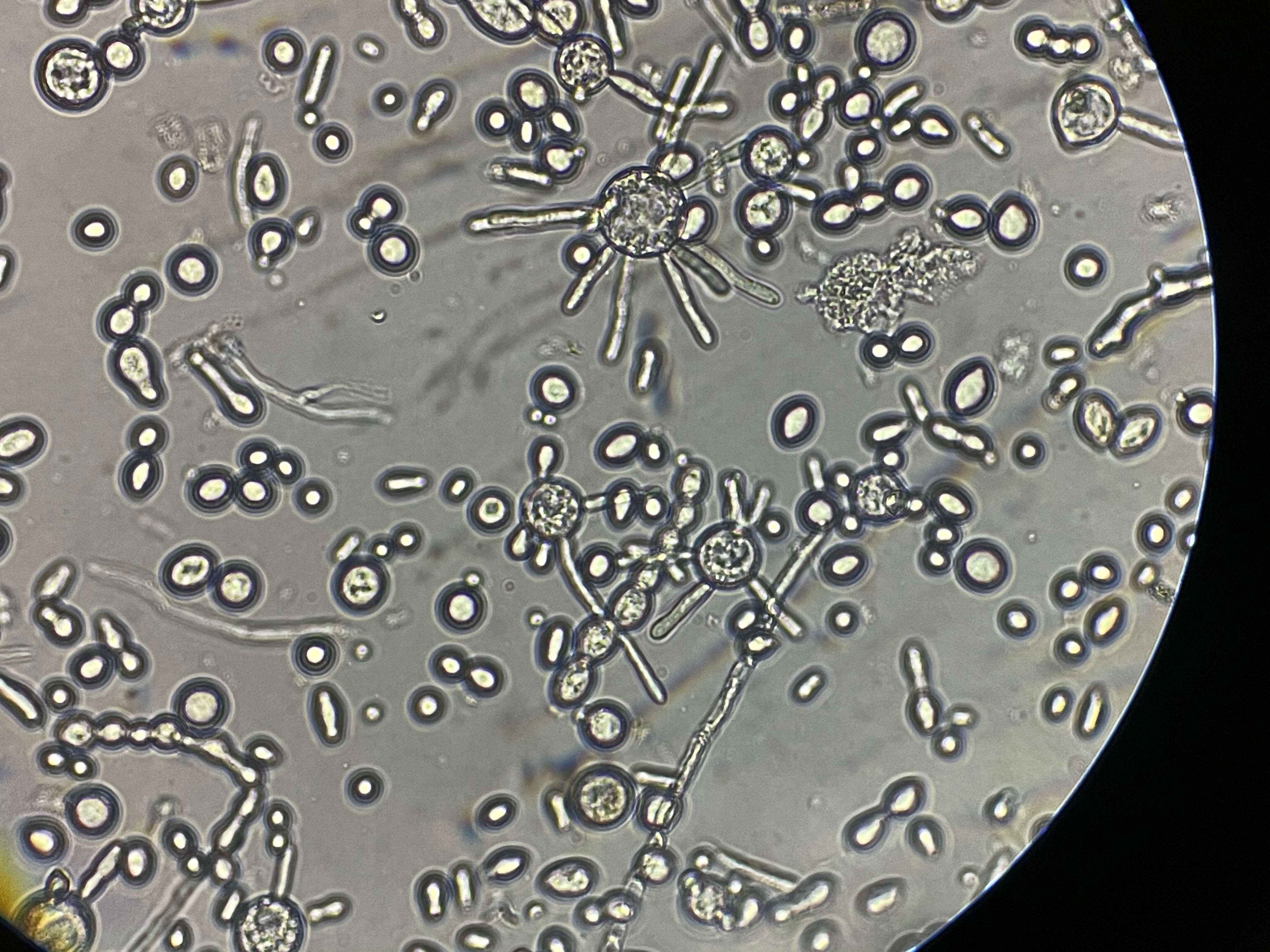 Urbanization and Waterway Microbial Ecology