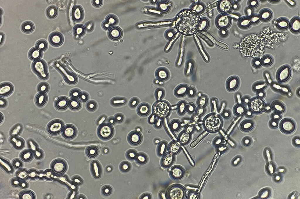 Life Cycle Plasticity and Genome Evolution in Basidiobolus